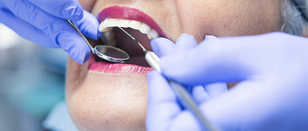 Best Emergency Dental Extractions in Battle Ground, WA